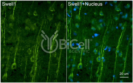 SWELL1 (LRRC8A) Antibody - FFPE Validated