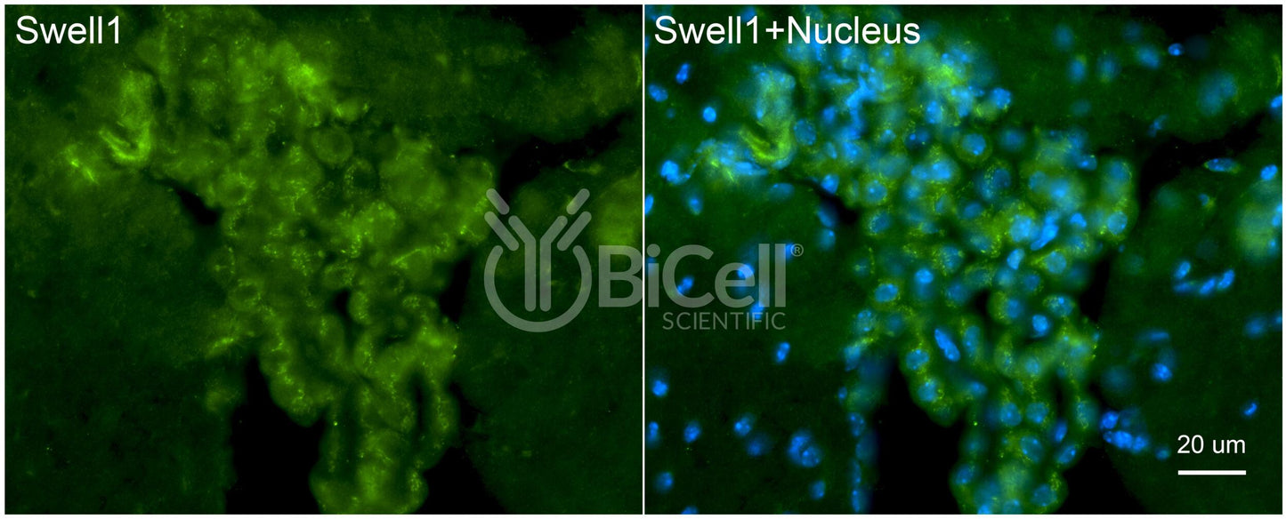 SWELL1 (LRRC8A) Antibody - FFPE Validated
