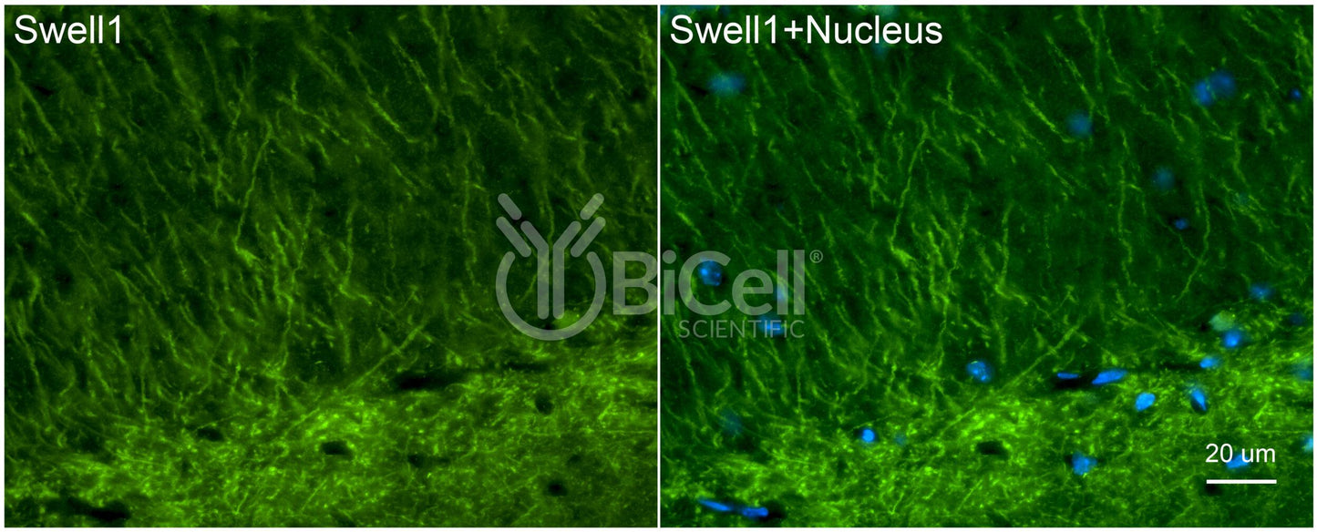 SWELL1 (LRRC8A) Antibody - FFPE Validated