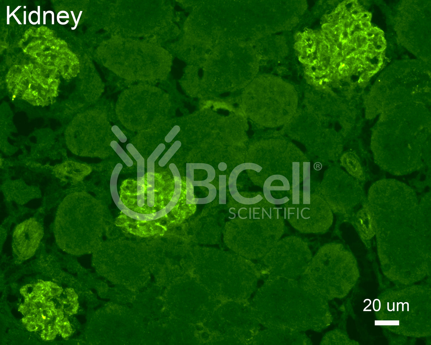 Synaptopodin (SYNPO) Antibody - FFPE Validated