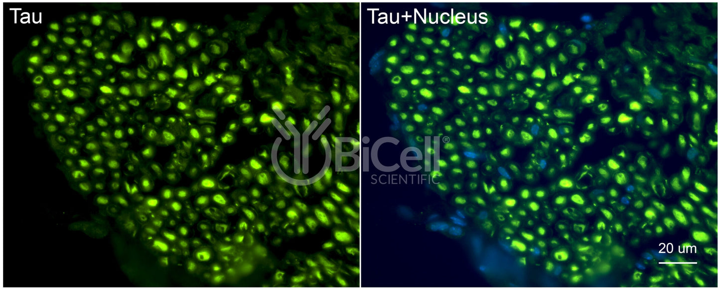 Tau (MAPT) Antibody - Western Blot Validated