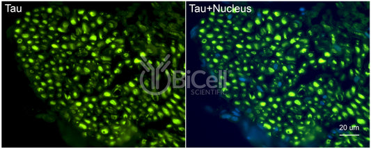 Tau (MAPT) Antibody - Western Blot Validated