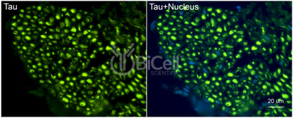 Tau (MAPT) Antibody