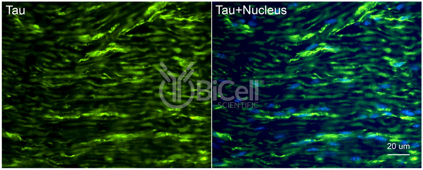 Tau (MAPT) Antibody