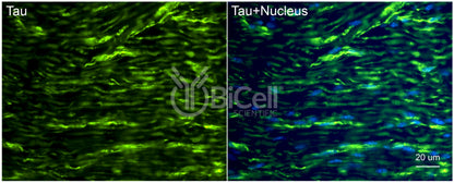 Tau (MAPT) Antibody