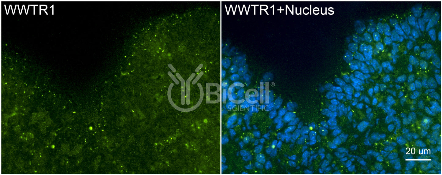 WWTR1 (TAZ) Antibody - FFPE Validated