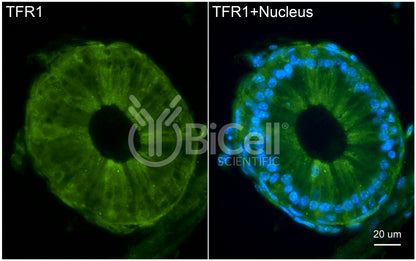 TFRC (TFR1 or CD71) Antibody - FFPE Validated
