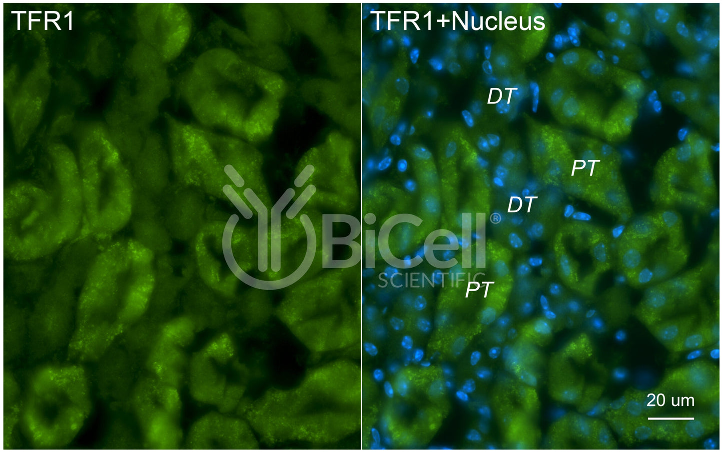 TFRC (TFR1 or CD71) Antibody - FFPE Validated