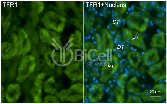 TFRC (TFR1 or CD71) Antibody - FFPE Validated