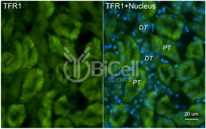 TFRC (TFR1 or CD71) Antibody