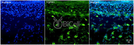 TGFBR1 (TGFR1) Antibody