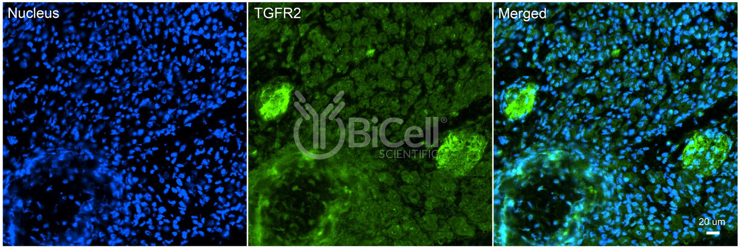 TGFBR2 (TGFR2) Antibody