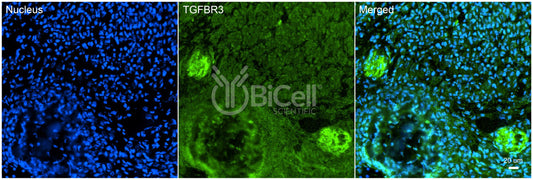TGFBR3 Antibody - Western Blot Validated