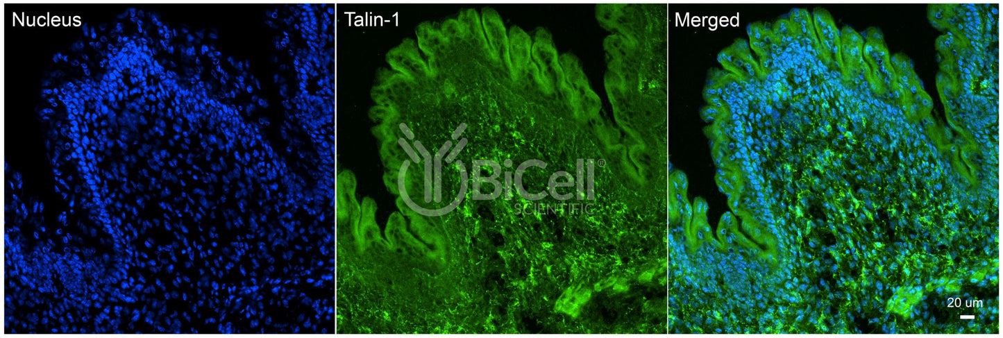 Talin-1 (TLN1) Antibody - Western Blot Validated