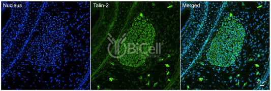 Talin-2 (TLN2) Antibody - Western Blot Validated