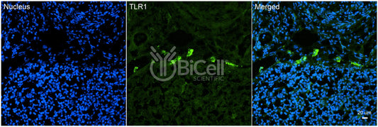 Toll-like receptor 1 (TLR1 or CD281) Antibody - Western Blot Validated