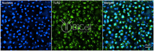 Toll-like receptor 2 (TLR2 or CD282) Antibody - FFPE Validated