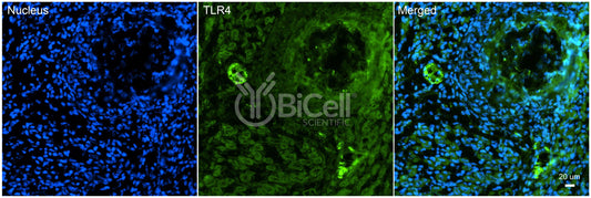Toll-like receptor 4 (TLR4 or CD284) Antibody - Western Blot Validated