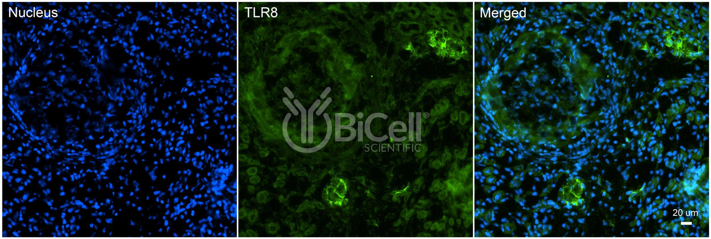 Toll-like receptor 8 (TLR8 or CD288) Antibody - FFPE Validated
