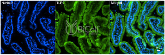 Toll-like receptor 9 (TLR9 or CD289) Antibody - FFPE Validated
