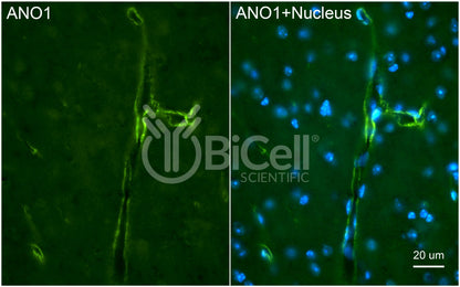 Anoctamin-1 (ANO1 or TMEM16A) (C-Terminus) Antibody - Western Blot Validated