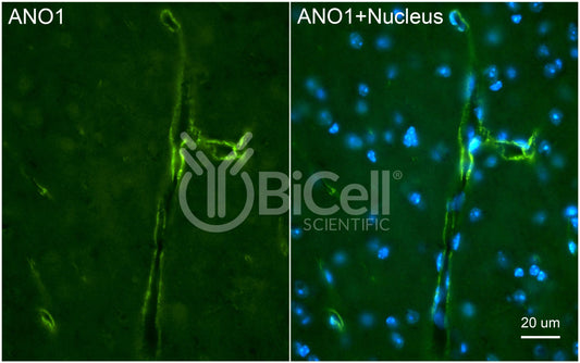 Anoctamin-1 (ANO1 or TMEM16A) (C-Terminus) Antibody - Western Blot Validated
