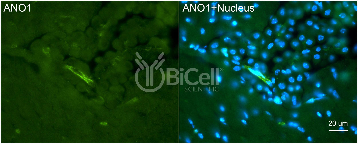 Anoctamin-1 (ANO1 or TMEM16A) (C-Terminus) Antibody - Western Blot Validated