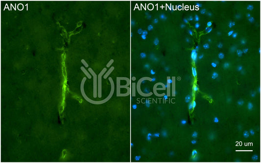 Anoctamin-1 (ANO1 or TMEM16A) (N-Terminus) Antibody