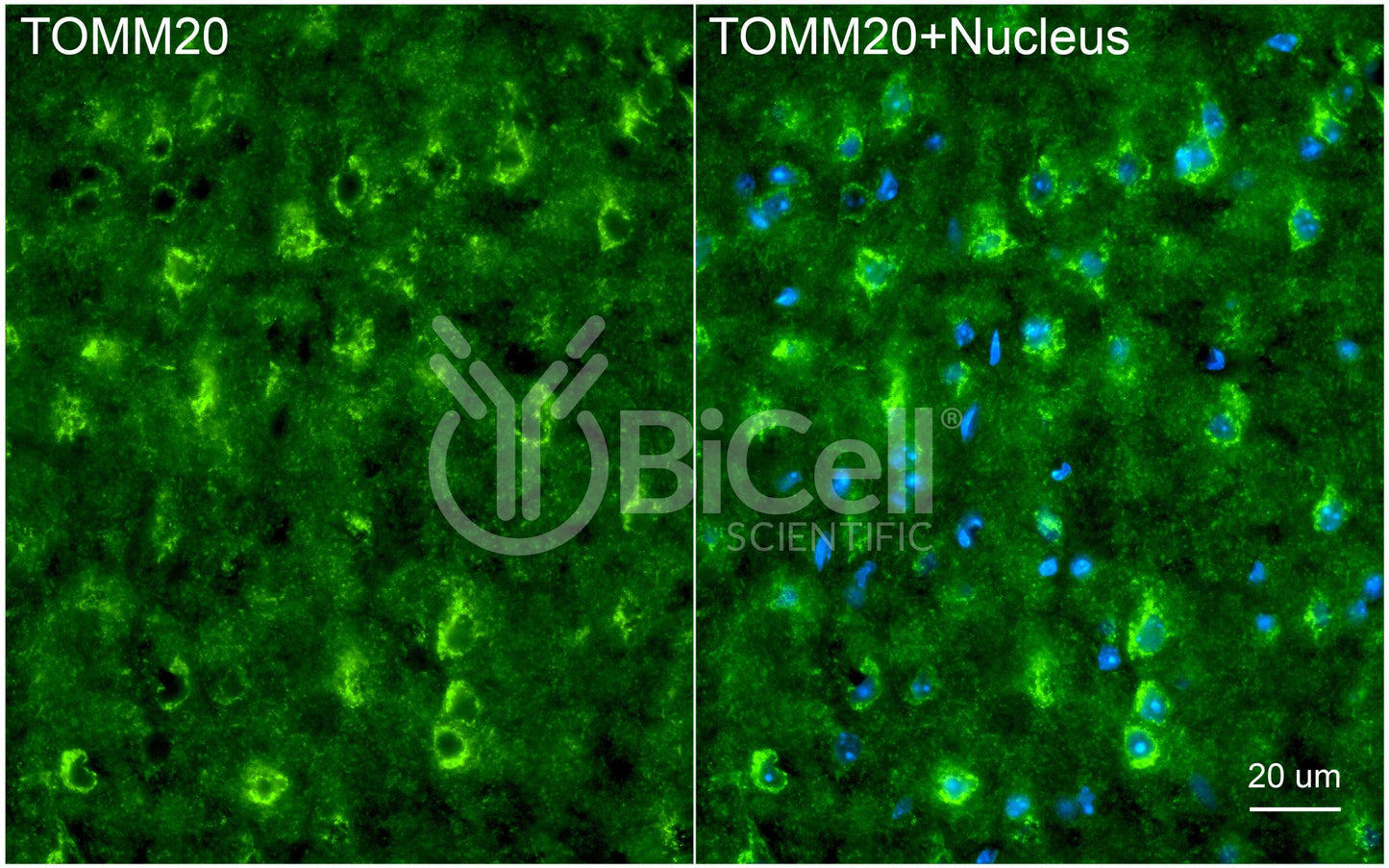 TOMM20 (MAS20) Antibody - FFPE Validated