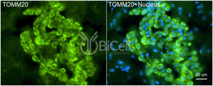 TOMM20 (MAS20) Antibody - FFPE Validated