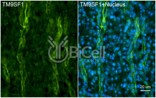 TM9SF1 Antibody - Western Blot Validated