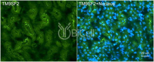 TM9SF2 Antibody