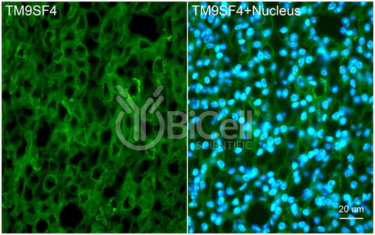 TM9SF4 Antibody - Western Blot Validated