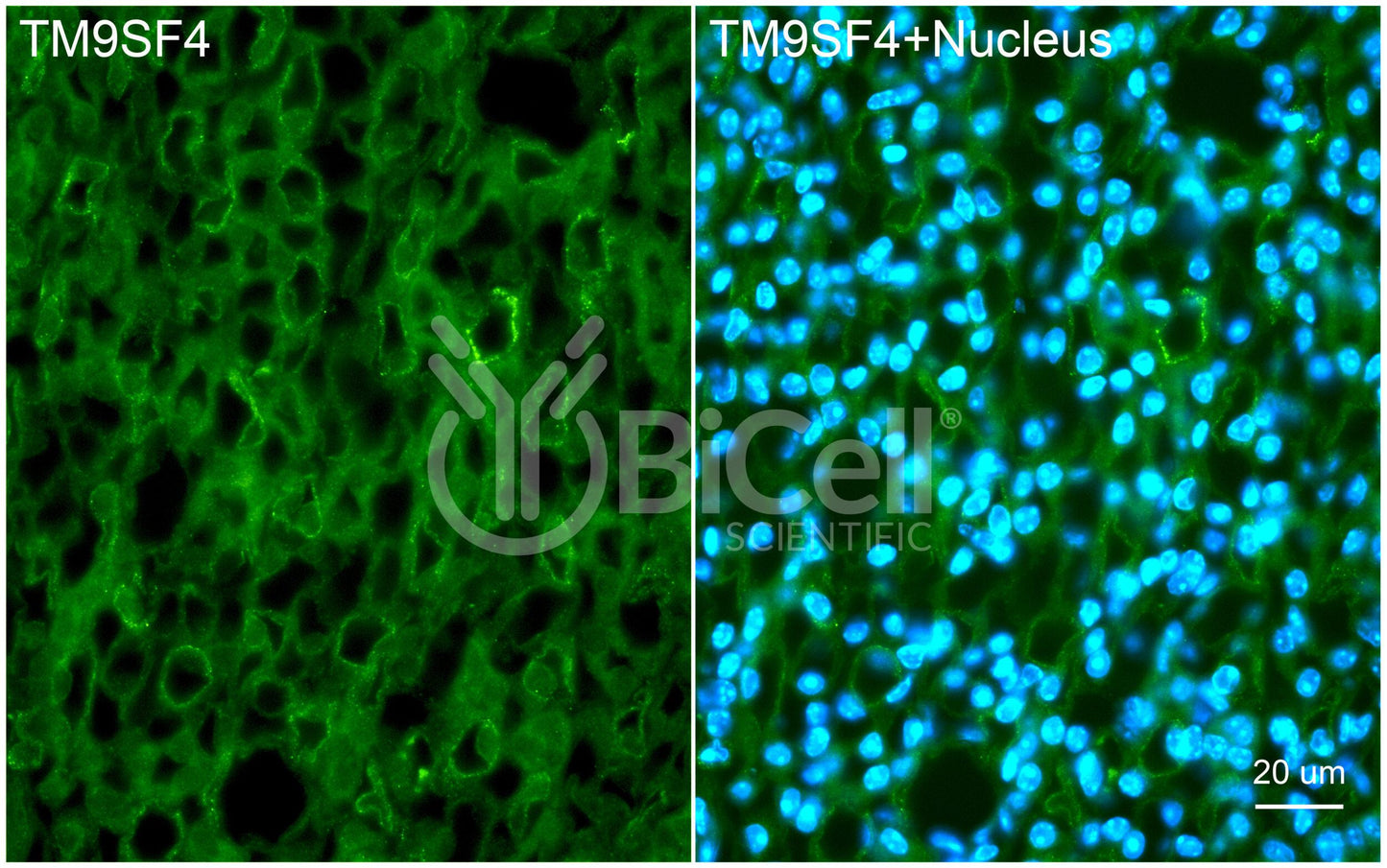 TM9SF4 Antibody - FFPE Validated