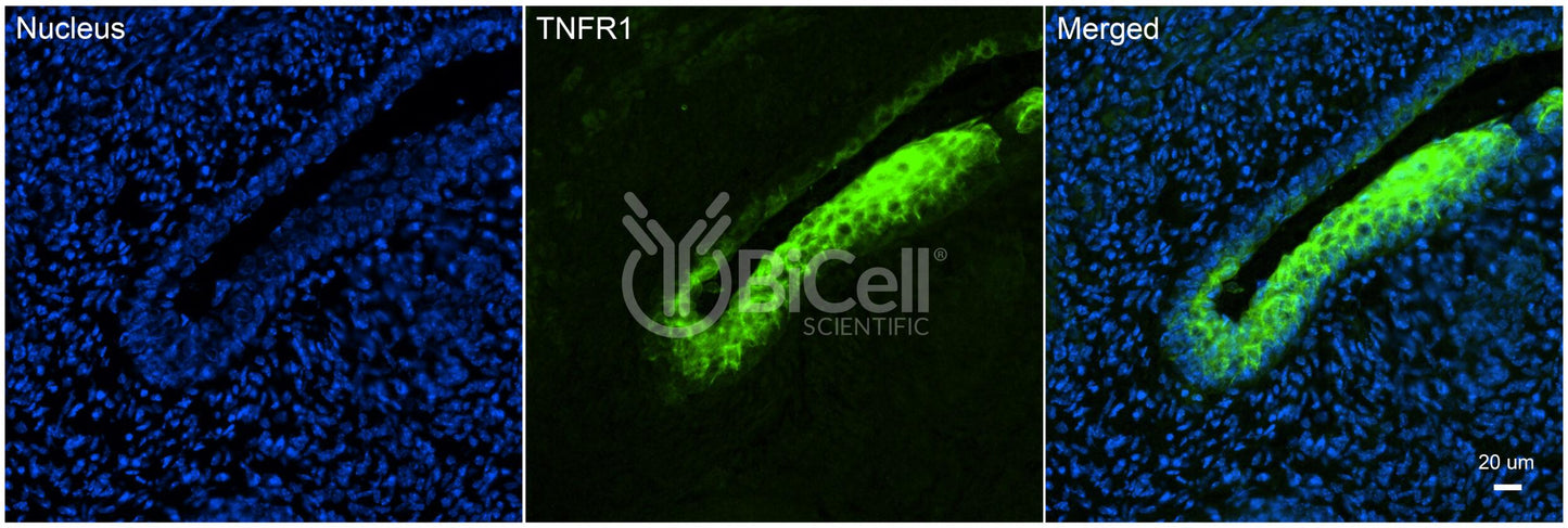 TNFRSF1A (TNFR1 or CD120a) Antibody - Western Blot Validated
