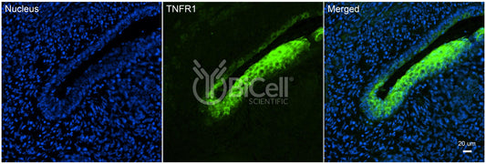 TNFRSF1A (TNFR1 or CD120a) Antibody - FFPE Validated
