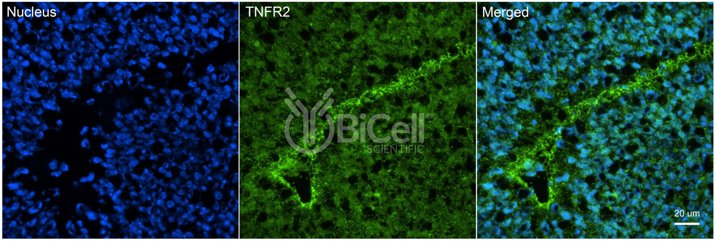 TNFRSF1B (TNFR2 or CD120b) Antibody - Western Blot Validated