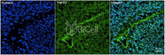 TNFRSF1B (TNFR2 or CD120b) Antibody - Western Blot Validated