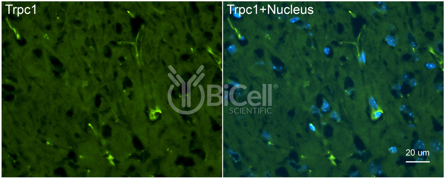 Trpc1 Antibody - FFPE Validated