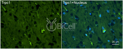 Trpc1 Antibody - FFPE Validated