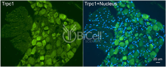 Trpc1 Antibody - Western Blot Validated