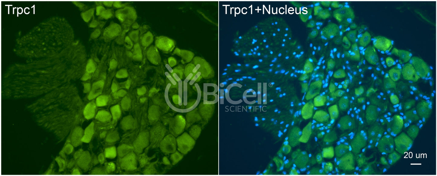 Trpc1 Antibody - FFPE Validated