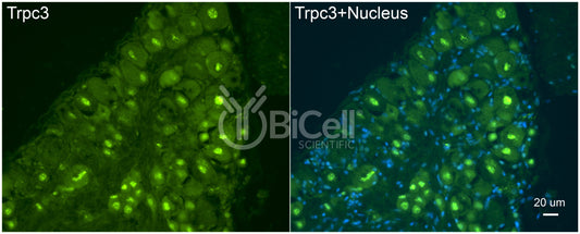 Trpc3 Antibody