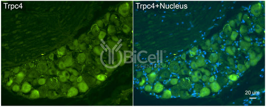 Trpc4 Antibody - Western Blot Validated