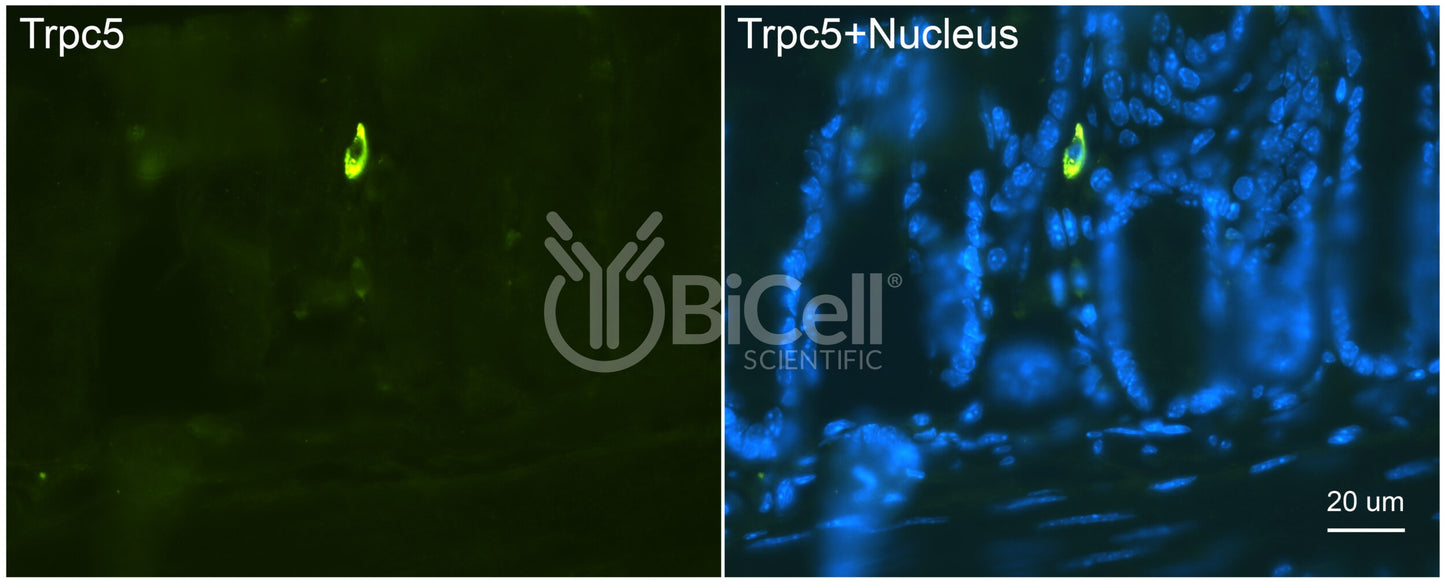 Trpc5 (N-Terminus) Antibody - Western Blot Validated