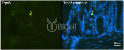 Trpc5 (N-Terminus) Antibody - FFPE Validated