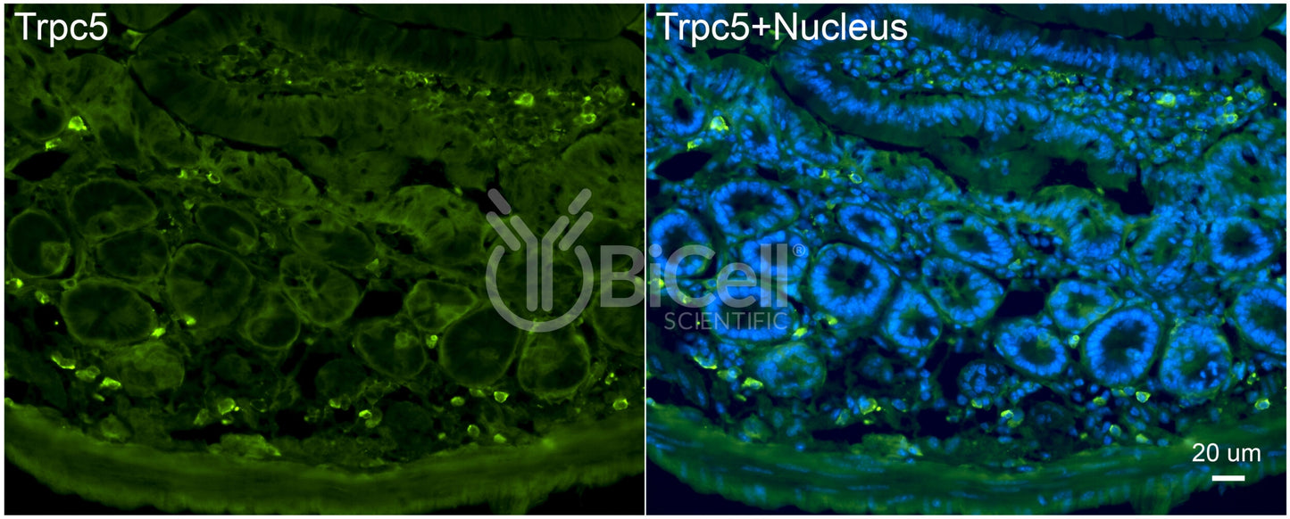 Trpc5 (N-Terminus) Antibody - Western Blot Validated