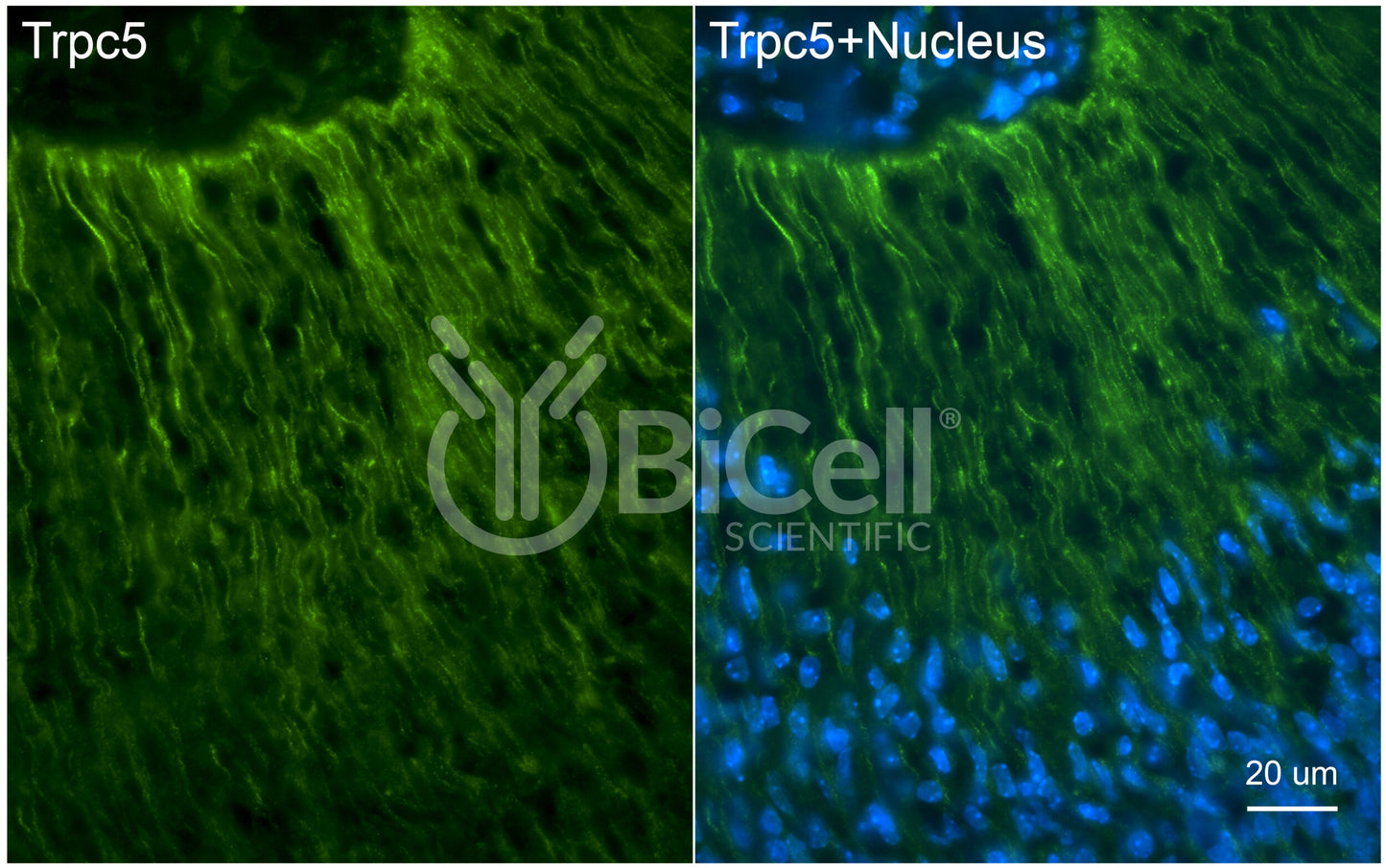 Trpc5 (C-Terminus) Antibody - Western Blot Validated