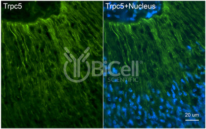 Trpc5 (C-Terminus) Antibody - Western Blot Validated