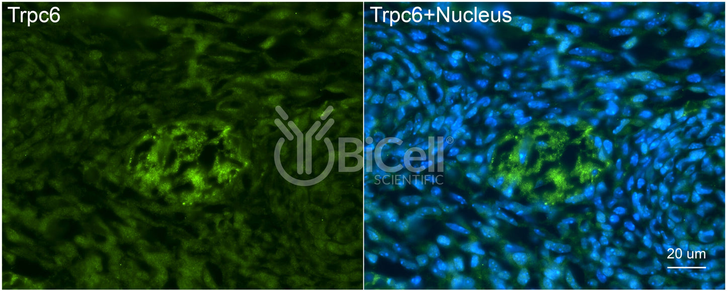 Trpc6 (N-Terminus) Antibody - FFPE Validated
